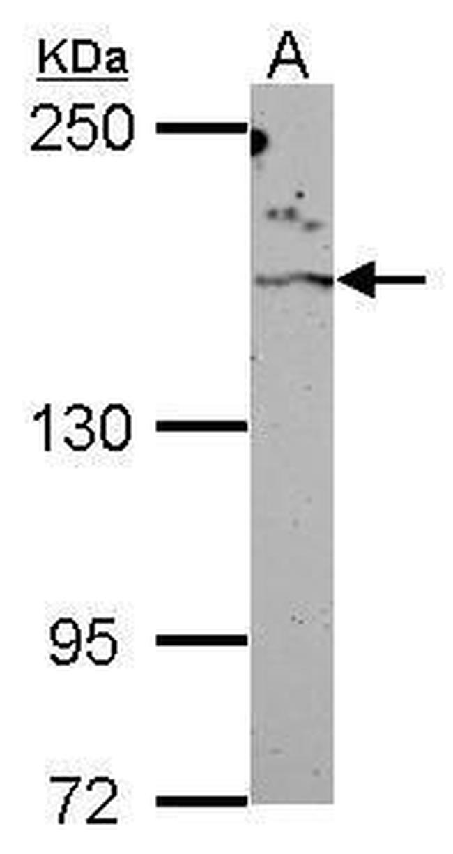 ROCK2 Antibody in Western Blot (WB)