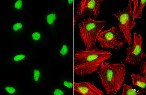 Histone H2A.X Antibody in Immunocytochemistry (ICC/IF)