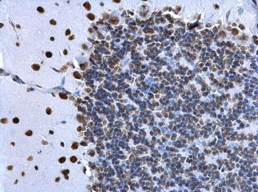 Histone H2A.X Antibody in Immunohistochemistry (Paraffin) (IHC (P))