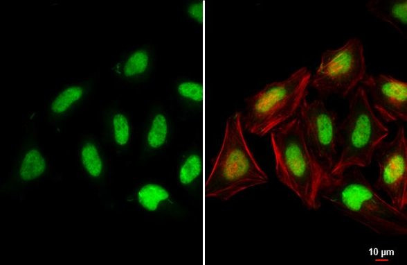 Histone H2A.X Antibody in Immunocytochemistry (ICC/IF)