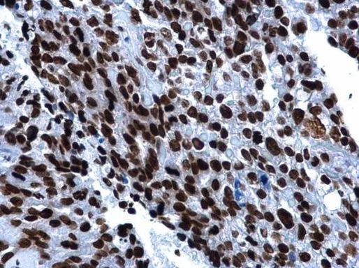 Histone H2A.X Antibody in Immunohistochemistry (Paraffin) (IHC (P))