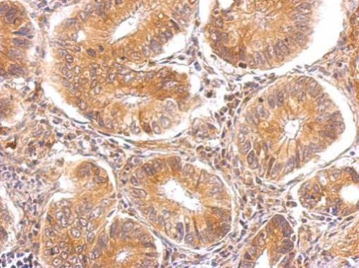 alpha TTP Antibody in Immunohistochemistry (Paraffin) (IHC (P))