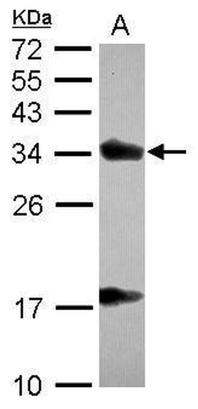 alpha TTP Antibody in Western Blot (WB)