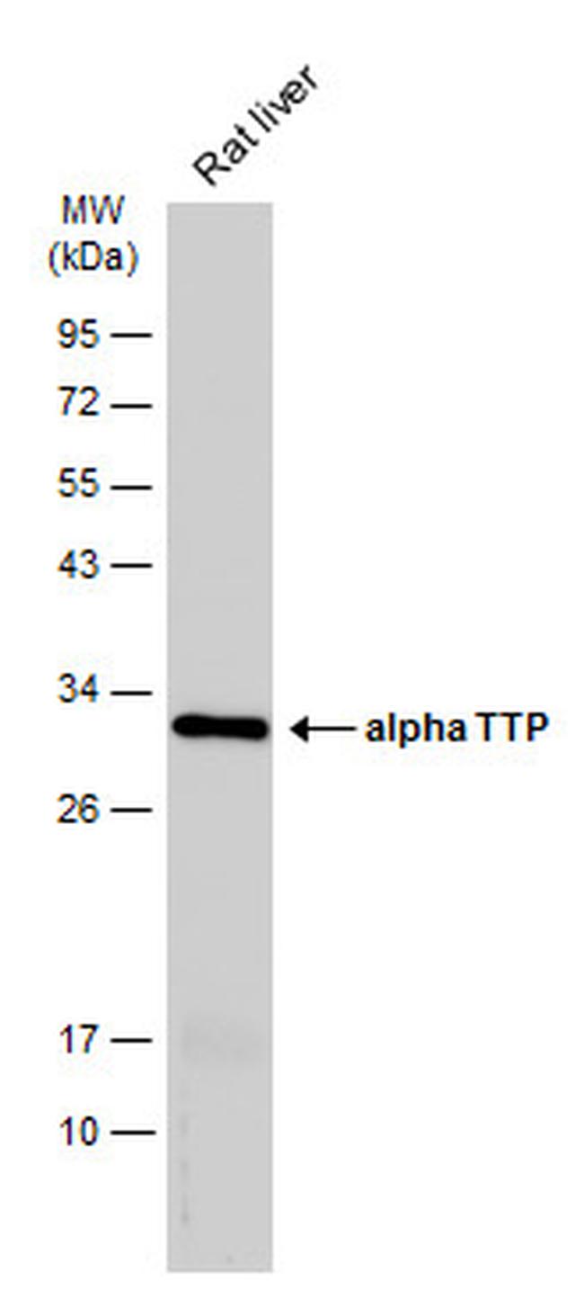 alpha TTP Antibody in Western Blot (WB)