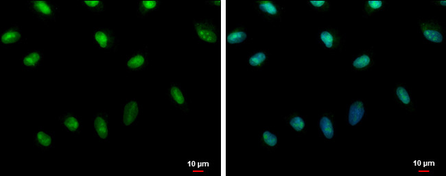 Histone H2A.X Antibody in Immunocytochemistry (ICC/IF)