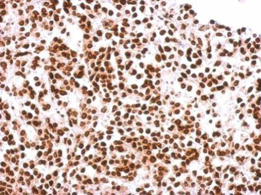 Histone H2A.X Antibody in Immunohistochemistry (Paraffin) (IHC (P))