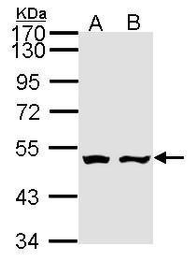 Adenylate Kinase 9 Antibody in Western Blot (WB)