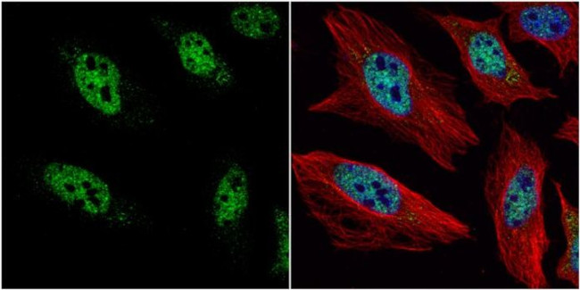 HES1 Antibody in Immunocytochemistry (ICC/IF)