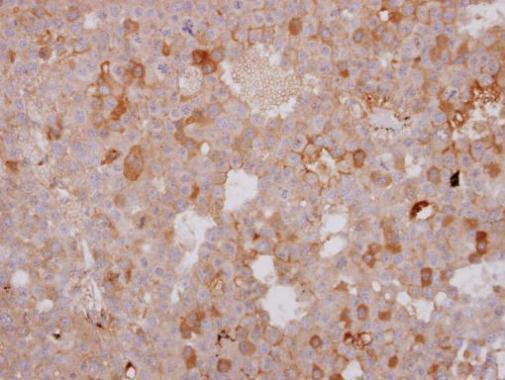 beta-1 Adrenergic Receptor Antibody in Immunohistochemistry (Paraffin) (IHC (P))