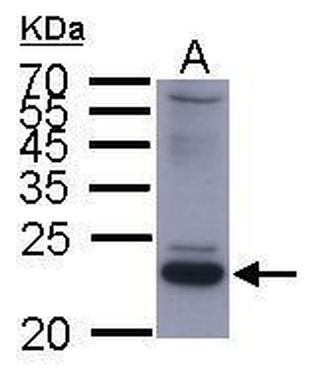 Hepatitis B Small S Protein Antibody in Western Blot (WB)