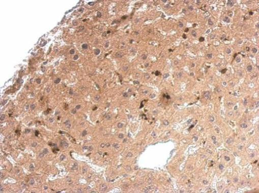 Syntenin 1 Antibody in Immunohistochemistry (Paraffin) (IHC (P))