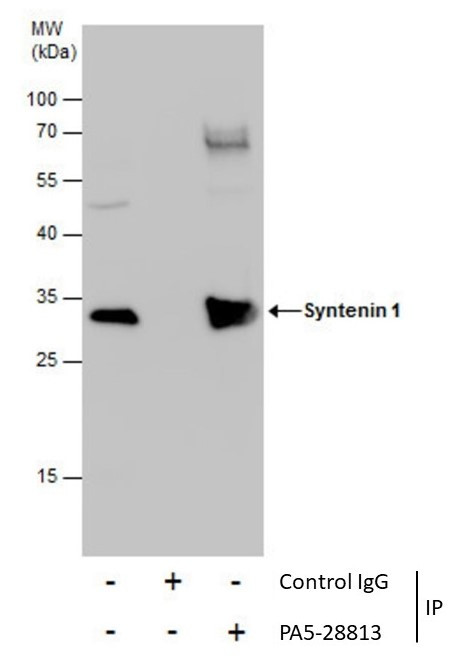 Syntenin 1 Antibody in Immunoprecipitation (IP)