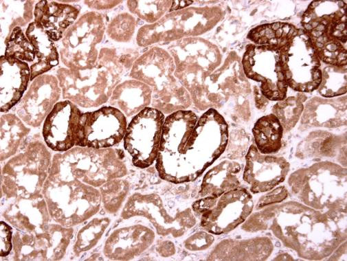 INHBB Antibody in Immunohistochemistry (Paraffin) (IHC (P))