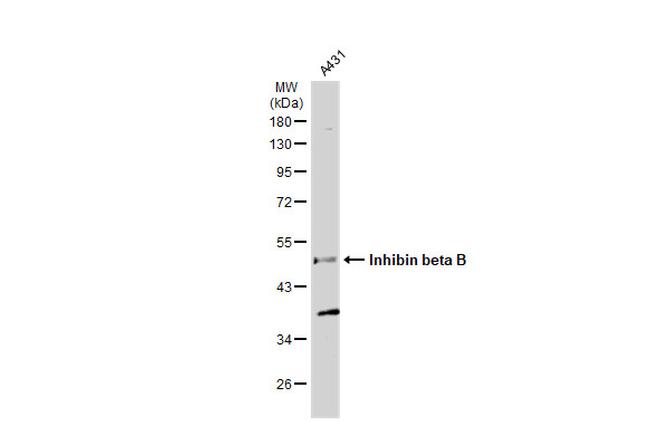 INHBB Antibody in Western Blot (WB)