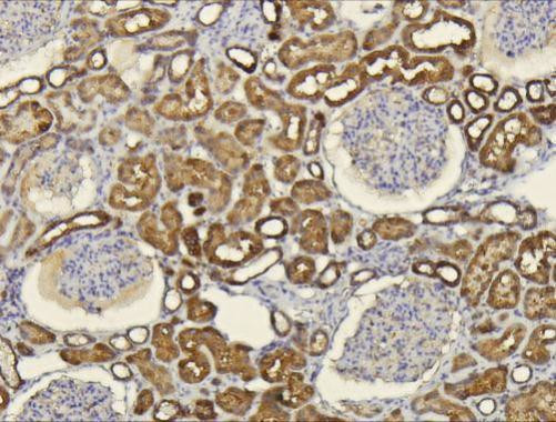 CXCL14 Antibody in Immunohistochemistry (Paraffin) (IHC (P))