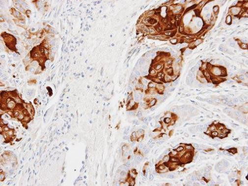 CCL28 Antibody in Immunohistochemistry (Paraffin) (IHC (P))