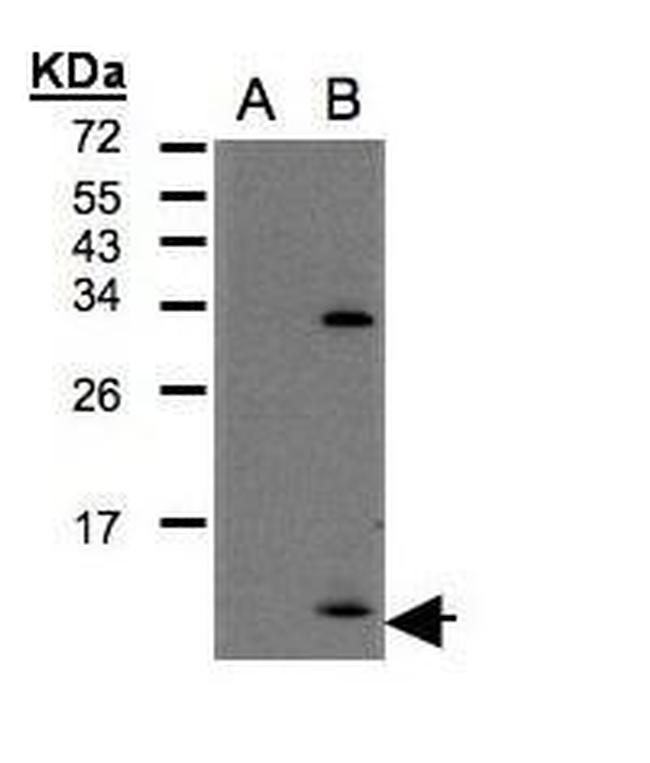 CXCL1 Antibody in Western Blot (WB)