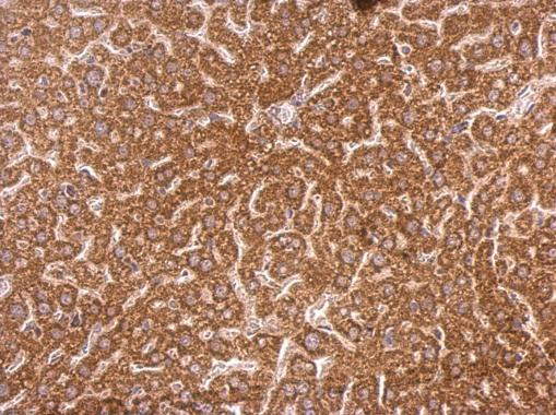 Syntenin 1 Antibody in Immunohistochemistry (Paraffin) (IHC (P))