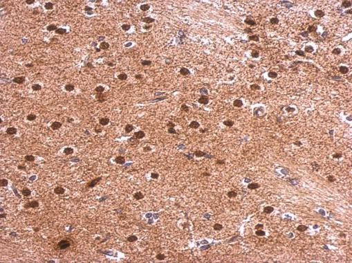 Syntenin 1 Antibody in Immunohistochemistry (Paraffin) (IHC (P))