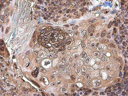 CXCL13 Antibody in Immunohistochemistry (Paraffin) (IHC (P))