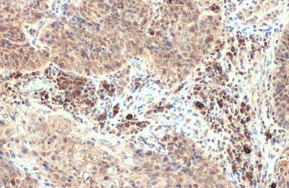 CXCL13 Antibody in Immunohistochemistry (Paraffin) (IHC (P))