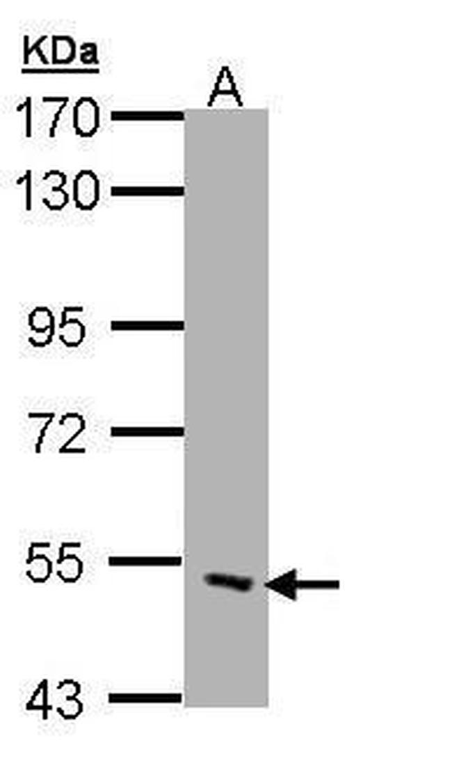 CHRND Antibody in Western Blot (WB)