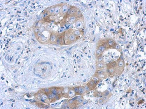 IL1R1 Antibody in Immunohistochemistry (Paraffin) (IHC (P))