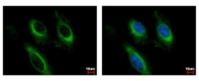 CD122 Antibody in Immunocytochemistry (ICC/IF)