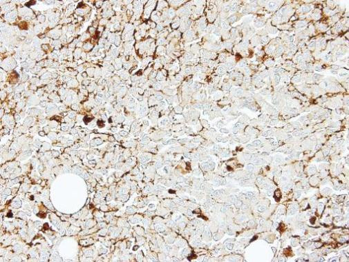 CD122 Antibody in Immunohistochemistry (Paraffin) (IHC (P))