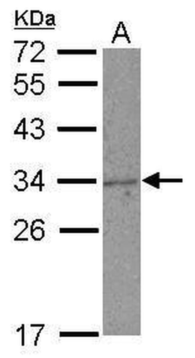 NKG2A Antibody in Western Blot (WB)