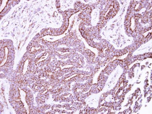 P2X5 Antibody in Immunohistochemistry (Paraffin) (IHC (P))