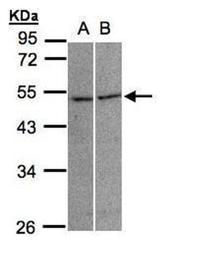 GLRA3 Antibody in Western Blot (WB)