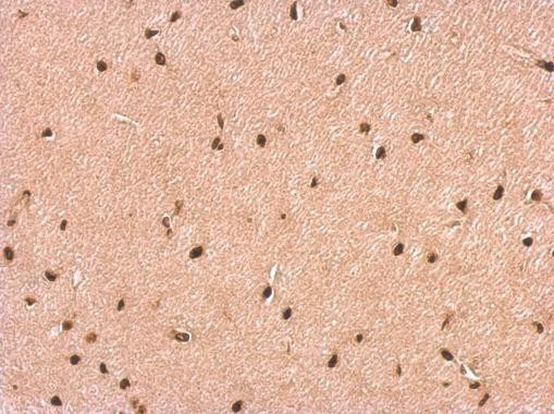 P2X2 Antibody in Immunohistochemistry (Paraffin) (IHC (P))