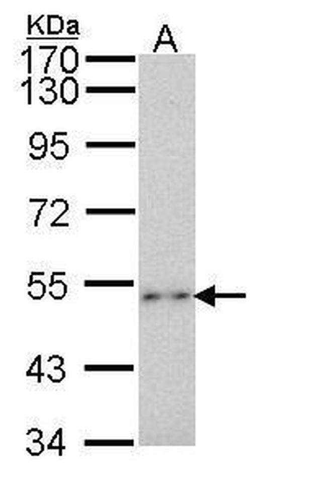 P2X2 Antibody in Western Blot (WB)