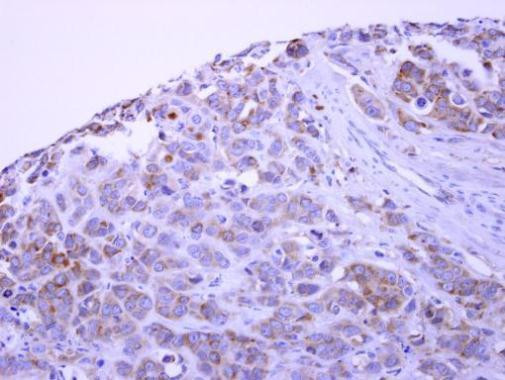 PACSIN1 Antibody in Immunohistochemistry (Paraffin) (IHC (P))