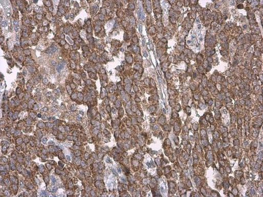 Cytochrome C Antibody in Immunohistochemistry (Paraffin) (IHC (P))