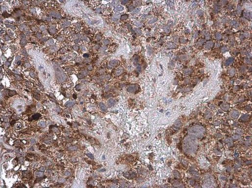 Cytochrome C Antibody in Immunohistochemistry (Paraffin) (IHC (P))