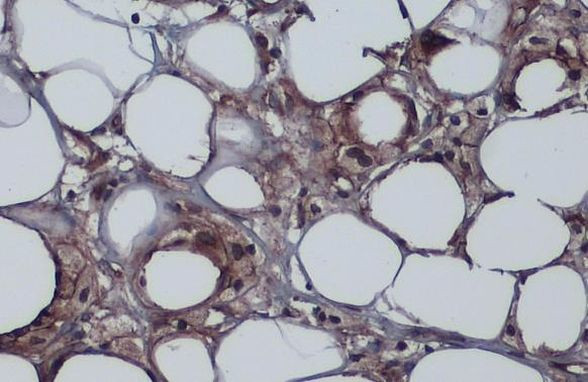 ZO-1 Antibody in Immunohistochemistry (Paraffin) (IHC (P))