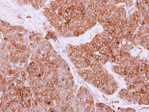 Rab4 Antibody in Immunohistochemistry (Paraffin) (IHC (P))