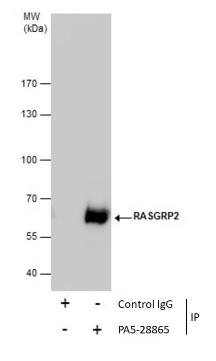 RASGRP2 Antibody in Immunoprecipitation (IP)