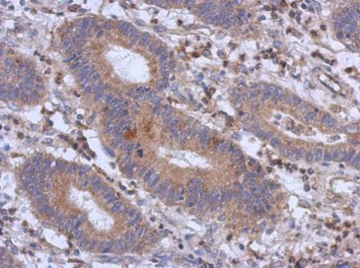 RFX6 Antibody in Immunohistochemistry (Paraffin) (IHC (P))