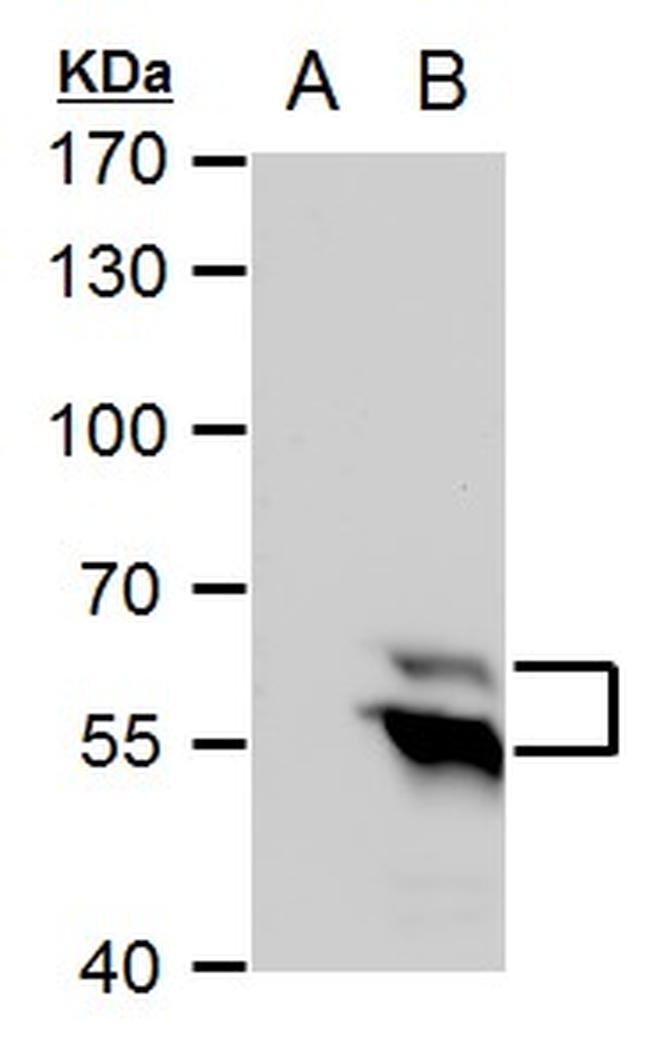 TdT Antibody in Western Blot (WB)