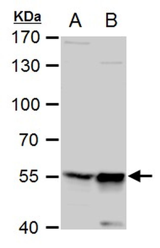 TdT Antibody in Western Blot (WB)