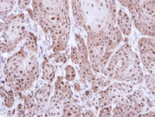 TrxR1 Antibody in Immunohistochemistry (Paraffin) (IHC (P))