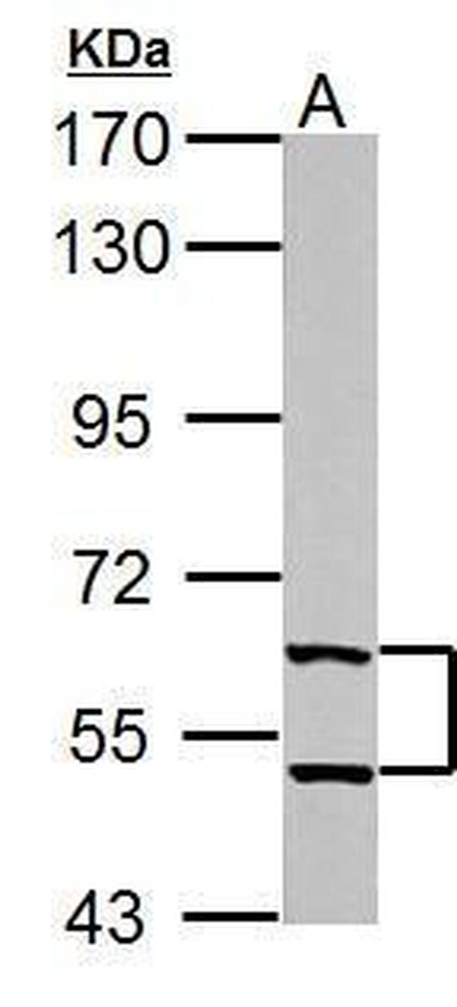 TrxR1 Antibody in Western Blot (WB)