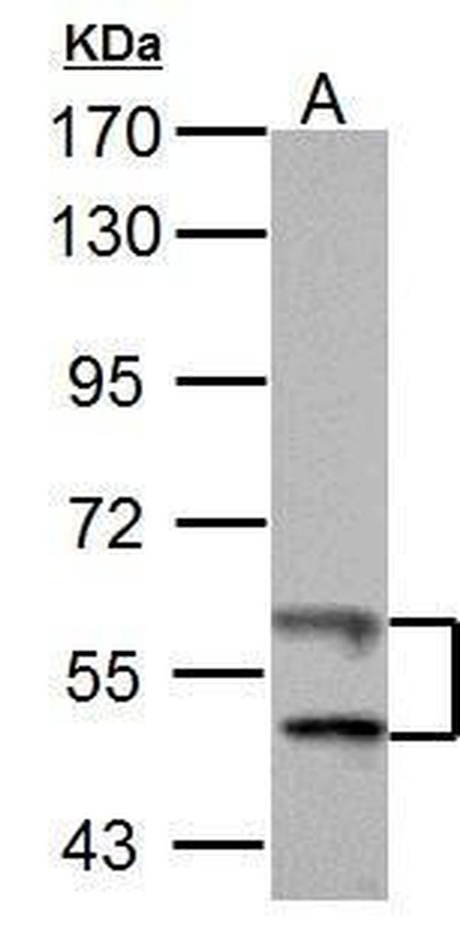 TrxR1 Antibody in Western Blot (WB)