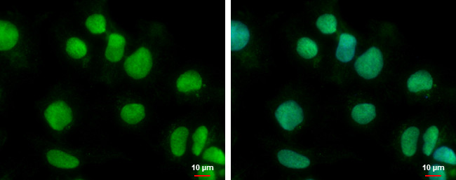 BTBD10 Antibody in Immunocytochemistry (ICC/IF)