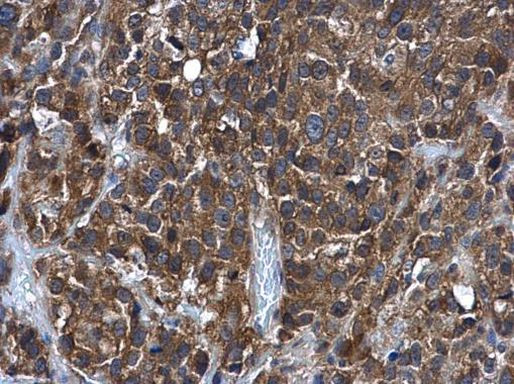 GSTM5 Antibody in Immunohistochemistry (Paraffin) (IHC (P))