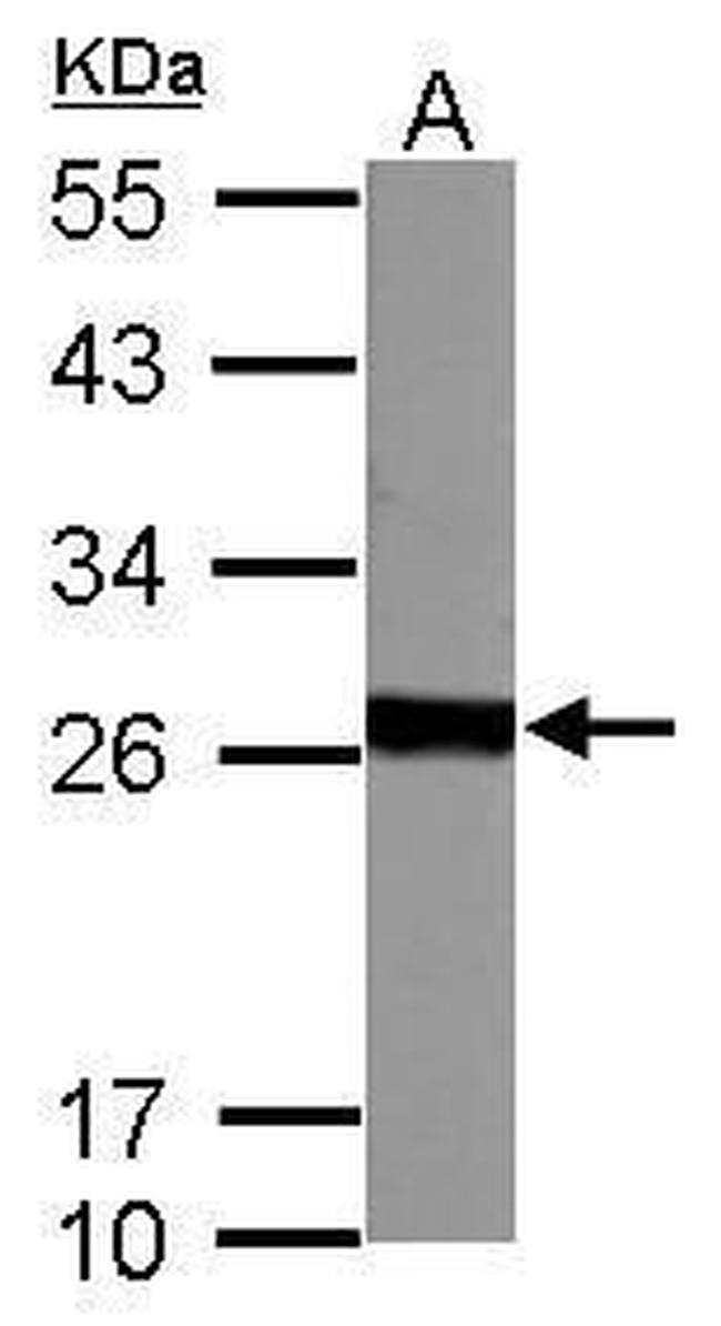 GSTM5 Antibody in Western Blot (WB)