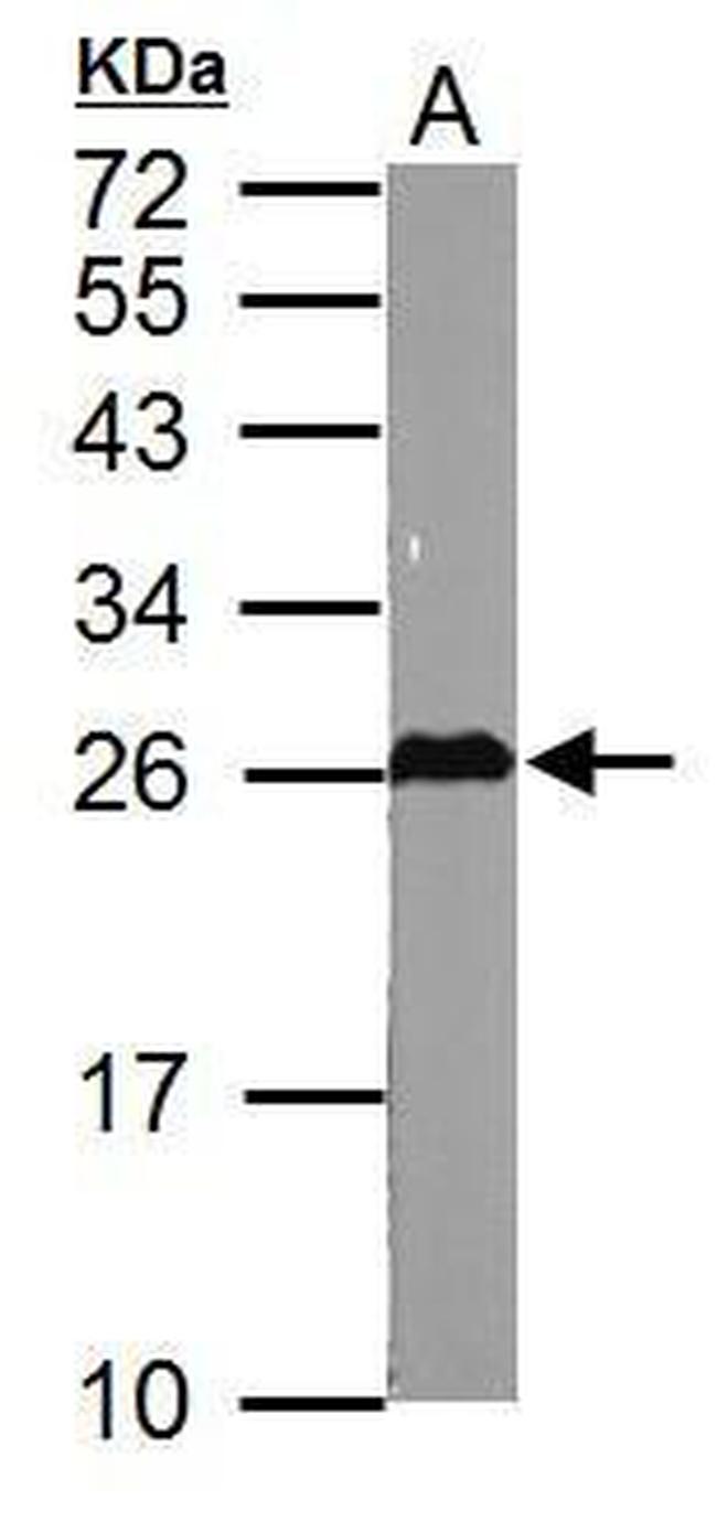 GSTM5 Antibody in Western Blot (WB)